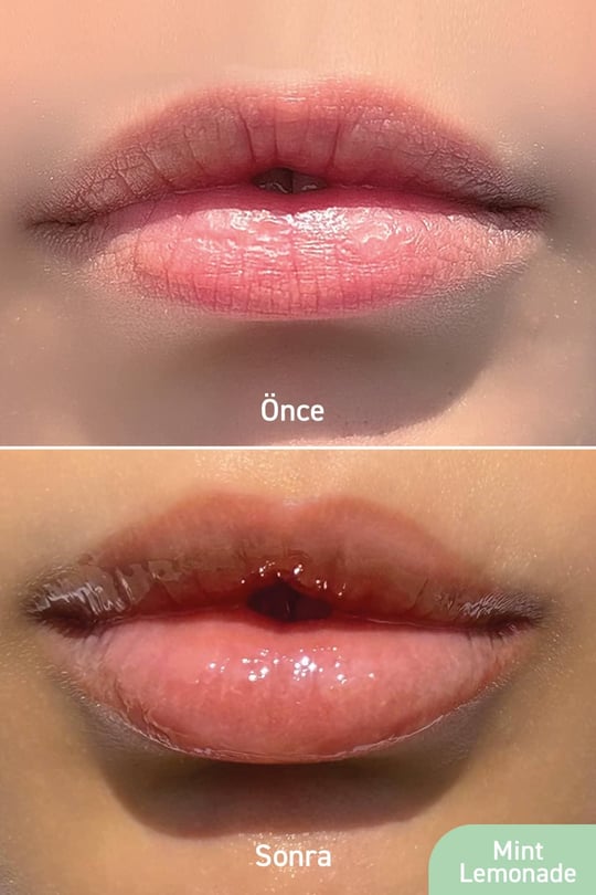 Herbaderm Parlatıcı, Dolgunlaştırıcı, Onarıcı Vegan Dudak Balmı, Limonata Aromalı 10 Ml HERBA701517