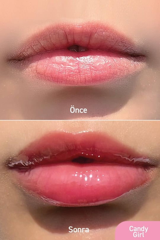 Herbaderm Parlatıcı, Dolgunlaştırıcı, Onarıcı Vegan Dudak Balmı, Tatlı Şeker Aromalı 10 Ml HERBA701516