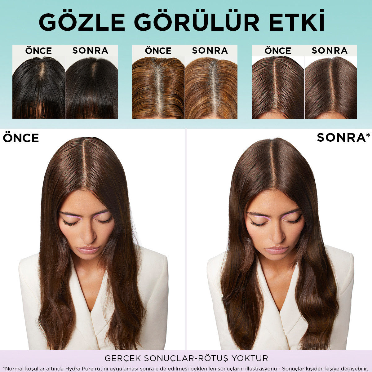 L'Oréal Paris Elseve Hydra [Hyaluronic] Pure Salisilik Asit İçeren Yağlanma Karşıtı Arındırıcı Şampuan 300ml