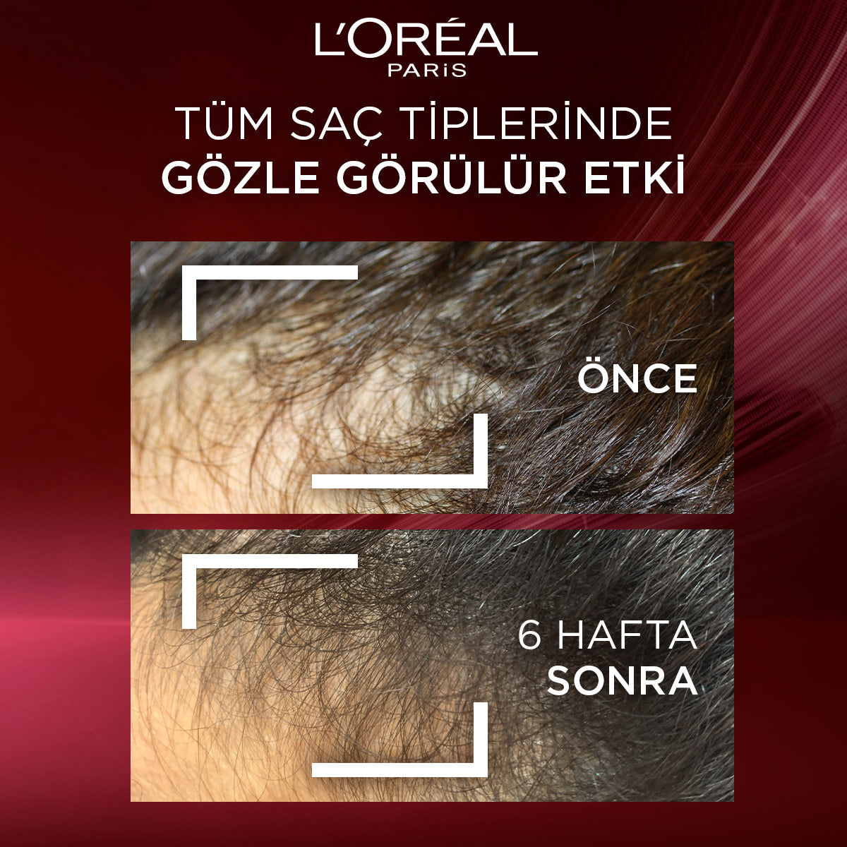 L'Oréal Paris Elseve Komple Direnç Dökülme Karşıtı Şampuan 300 ml