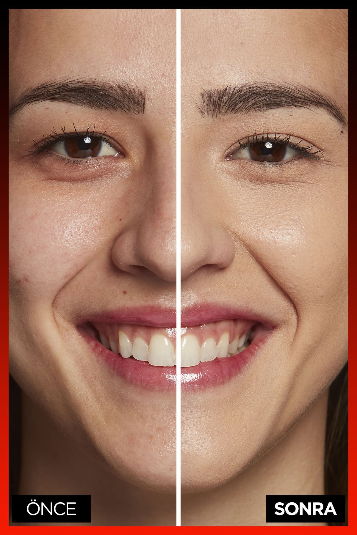 L'Oréal Paris Infaillible 24H Tüm Yüze Uygulanabilir Kapatıcı - 330 Pecan