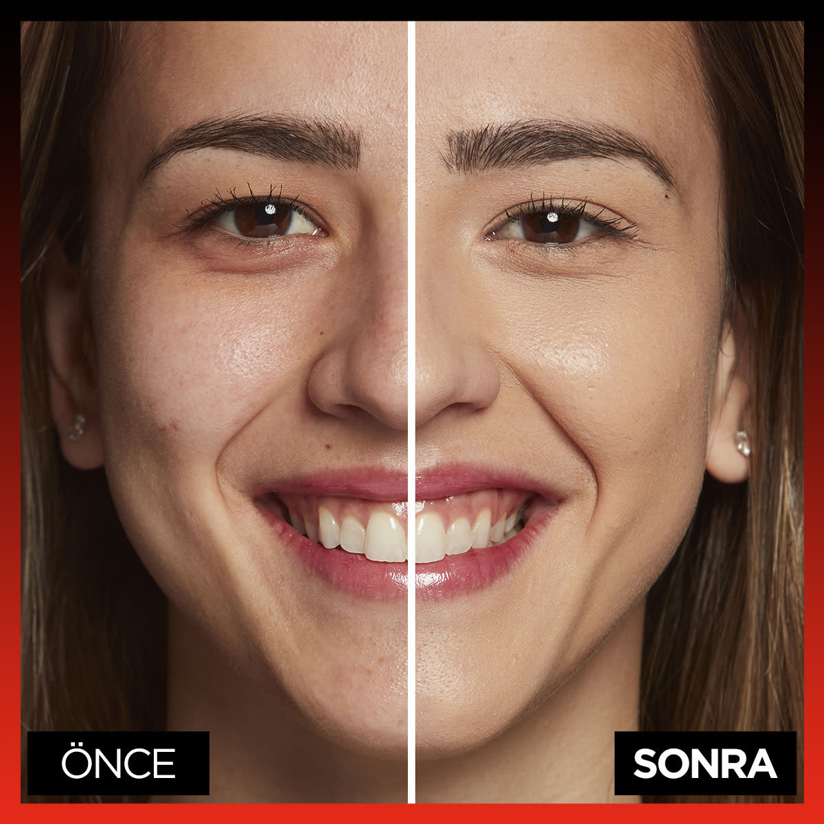 L'Oréal Paris Infaillible 24H Tüm Yüze Uygulanabilir Kapatıcı - 330 Pecan