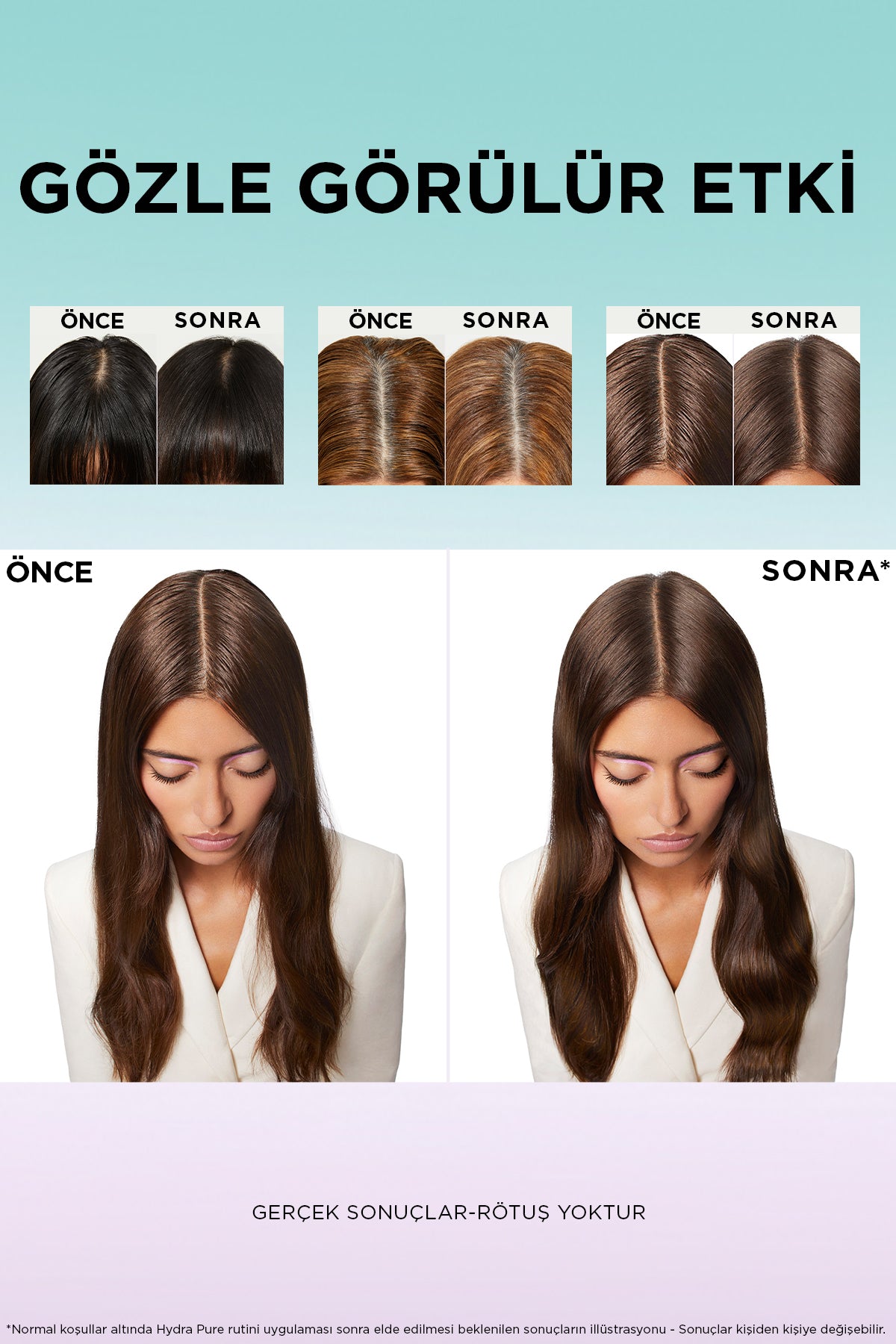 Elseve Hyaluron Pure Scalp Serum